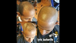 Barber techniques on BLENDING BALDING THIN HAIR INSTAGRAM lyristheartist [upl. by Nomis]