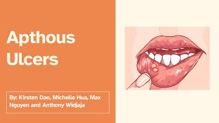 Aphthous Ulcers [upl. by Mirelle]