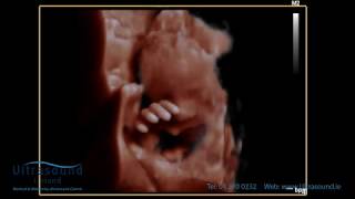 Scan of the Week 28 week baby waving hello during our 3D4D Ultrasound [upl. by Mallissa]