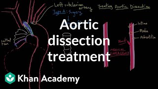 Aortic dissection treatment  Circulatory System and Disease  NCLEXRN  Khan Academy [upl. by Neelyad]