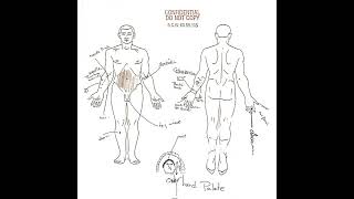 Autopsy The Last Hours of John Candy  Part 5 [upl. by Quar]