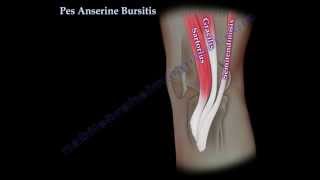 Pes Anserine Bursitis  knee pain  Everything You Need To Know  Dr Nabil Ebraheim [upl. by Michal]