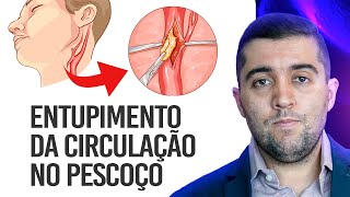 Qual risco da doença nas carótidas as artérias que levam sangue para a cabeça e o pescoço [upl. by Eniamej]