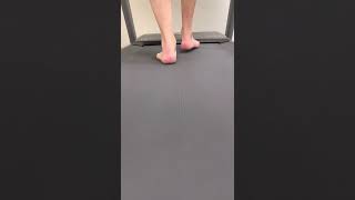 Excessive subtalar eversion creating an unstable midtarsal joint and hip pain [upl. by Siulesoj784]