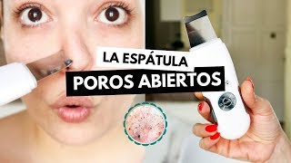 Pruebo la ESPÁTULA ULTRASÓNICA contra POROS ABIERTOS y sebo facial  Pretty and Olé [upl. by Euqinamod]