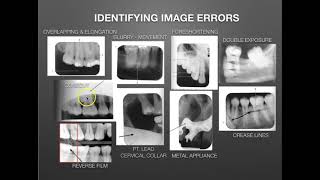 Image Evaluation for an FMX Identifying amp Correcting Errors [upl. by Cindi]