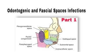 Odontogenic and Fascial Spaces Infections طب الأسنان مرحلة رابعة oralsurgery [upl. by Glori]