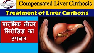 Treatment of liver cirrhosis  chronic liver disease  compensated cirrhosis [upl. by Yeh]