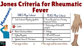 Jones Criteria for Rheumatic Fever  Jones Criteria for Rheumatic Fever Mnemonic  Jones Criteria [upl. by Nagaer]