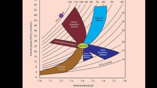 Part 2 Acidosis and Alkalosis Metabolic or Respiratorymp4 [upl. by Notsuoh]