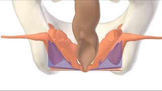 3D Ischioanal Ischiorectal Fossa [upl. by Gipsy306]