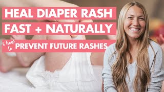 Preventing Diaper Rash  Aquaphor® Baby [upl. by Adhamh]