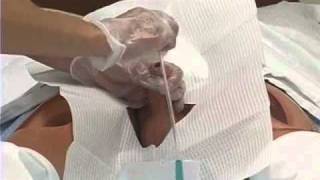 Foley Catheter Skills Demonstration 2 of 3 [upl. by Eustazio823]