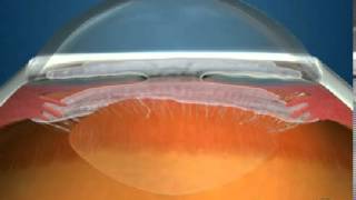 How Fluid Circulates in the Eye [upl. by Halehs]