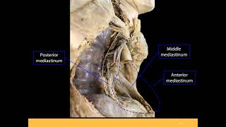 Mediastinum PPT Slide Presentation [upl. by Pan]