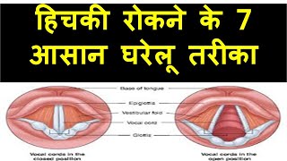 हिचकी बंद करने का 7 सबसे आसान तरीका how to get rid of hiccups hichki kyu aati hai aur iska ilaj [upl. by Kammerer]