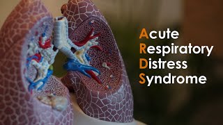 Acute Respiratory Distress Syndrome ARDS for USMLE Step1 and USMLE Step 2 [upl. by Geraldina]