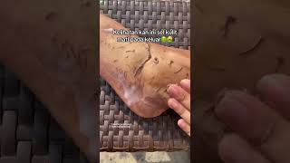 Deep Cleansing Remove Dust and Dead Skin ameenbeautytips [upl. by Dianna]