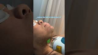 PCOS Facial Hair Laser Hair Removal Treatment [upl. by Ttelracs]