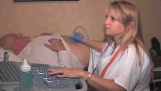 AAA Ultrasound Screening [upl. by Askwith]