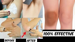 How To Lighten Dark Knees Dark Elbows Dark Underarms  Lighten Your Dark Body Parts Naturally [upl. by Ardnassak]