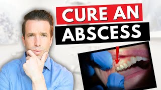 Dentist Explains a Tooth Abscess  How to Cure an Abscess Tooth [upl. by Annaillil]