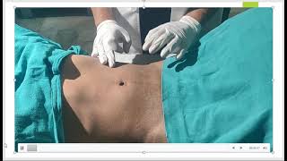 2 Abdominal Examination [upl. by Draned]