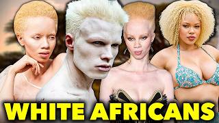 The Beautiful WHITE BLACK Africans [upl. by Samalla483]