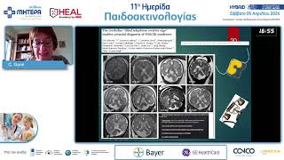 Fetal Imaging of posterior fossa malformations  C Garel [upl. by Warfield]