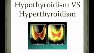 HYPOTHYROIDISM VS HYPERTHYROIDISM [upl. by Sualokin88]