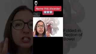 Name this disorder 22 Pediatrics SHORT  LevelUpRN [upl. by Merrilee608]