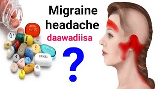 Daawada ugu fiican ee madax xanuunka nooca migraineka lagu daaweeyo [upl. by Kylie274]