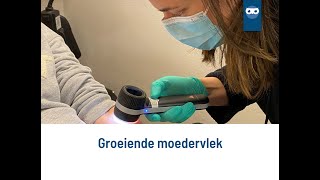 groeiende moedervlek [upl. by Ainocal]