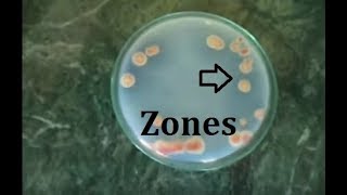 How to isolate phosphate solubilizing bacteria [upl. by Aicilak200]