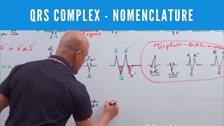 ECG  QRS Complex in EKG  Nomenclature  Electrocardiography🫀 [upl. by North]