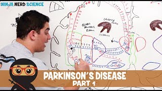 Parkinsons Disease  Clinical Presentation  Part 1 [upl. by Coheman]