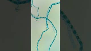 🤖 Spirogyra Conjugación bajo el microscopio 🤖 🔬 [upl. by Ori]