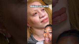 Understanding Albinism SHOWING how to learn and lash behind the scenes lashes [upl. by Laina]