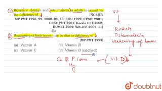 Rickets in children and osteomalacia in adults is caused by the deficiency of [upl. by Idnod]