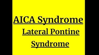 AICA Syndrome Lateral pontine syndrome [upl. by Jobina967]