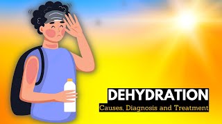 What is Dehydration Causes Signs and Symptoms Diagnosis and Treatment [upl. by Halullat840]