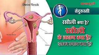 Uterine Fibroid Symptoms Precautions amp Treatment  Rasoli ka Ilaj in Hindi ft Dr Mangla Dogra [upl. by Cumine195]