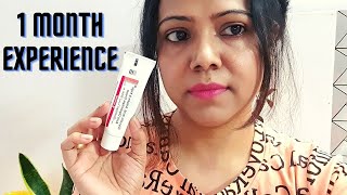 My 1 Month Experience with Demelan Cream  Honest Review [upl. by Mercuri]