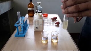 Urine Analysis for Abnormal Constituent Detection of Urine Ketone Bodies  यूरिन टेस्ट फॉर कीटोन [upl. by Sneed128]