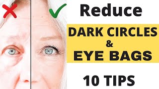 LOOK 10 YEARS YOUNGER EYE BAGS amp DARK CIRCLES CONCEALING [upl. by Irtimid]