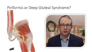 Piriformis Syndrome or Deep Gluteal Syndrome [upl. by Hgielrac877]