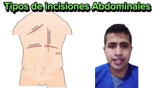 Tipos de incisiones Abdominales [upl. by Jessalin966]