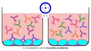 T2 TÉCNICAS DE INMUNODIAGNÓSTICO [upl. by Linnell]