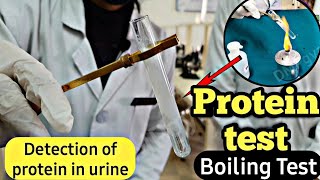 Detection of protein in urine  Protein test in urine  Boiling test  Protein test [upl. by Angelle440]