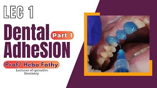 Operative 4  Lec 1  Dental Adhesion Part 1 [upl. by Amihc943]